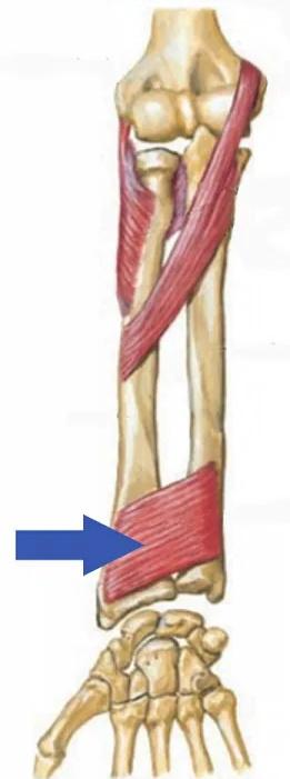 Imagen clínica de la pregunta de Traumatología