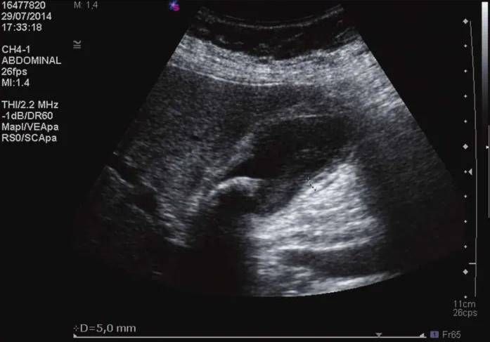 Imagen clínica de la pregunta de Digestivo