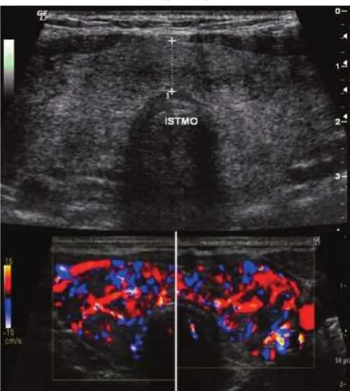Imagen clínica de la pregunta de Endocrinología