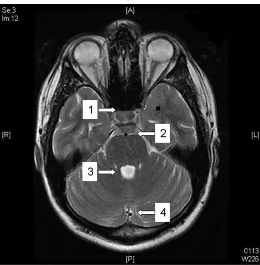 Imagen clínica de la pregunta de Neurología