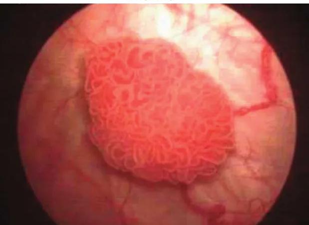Imagen clínica de la pregunta de Oncología