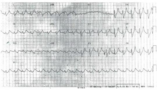 Imagen clínica de la pregunta de Cardiología