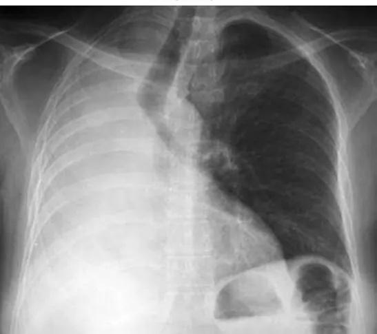 Imagen clínica de la pregunta de Respiratorio