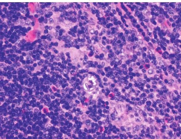 Imagen clínica de la pregunta de Hematología