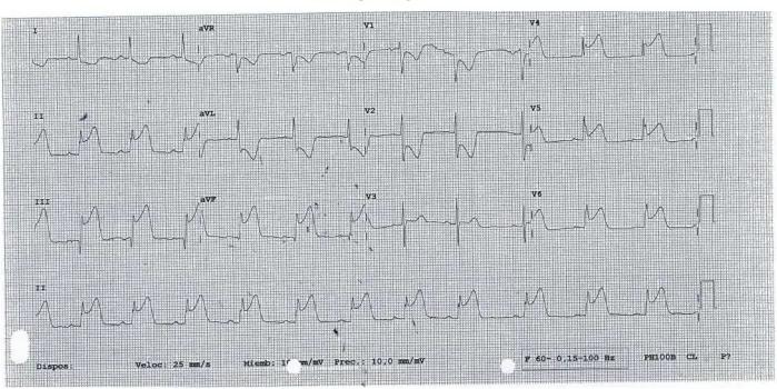 Imagen clínica de la pregunta de Cardiología