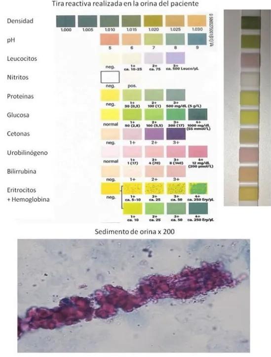 Imagen clínica de la pregunta de Hematología