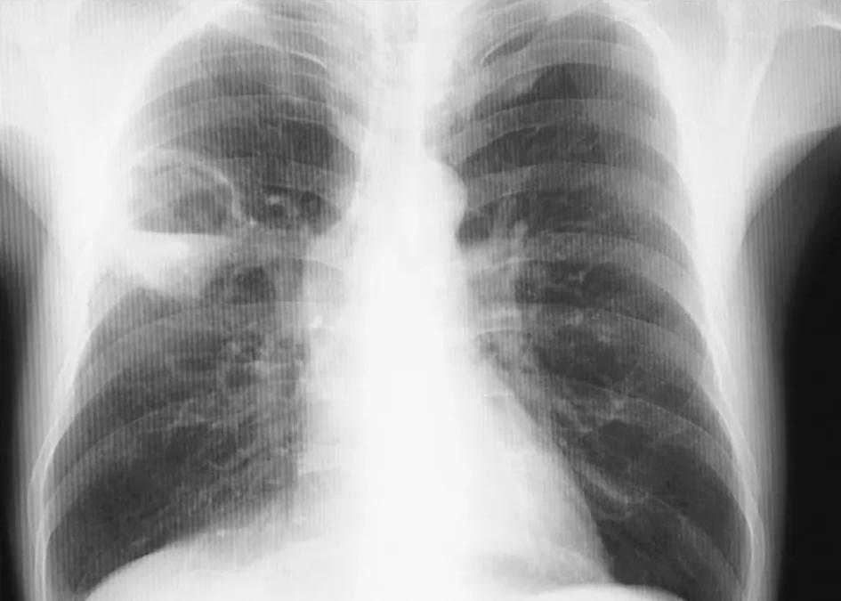 Imagen clínica de la pregunta de Respiratorio