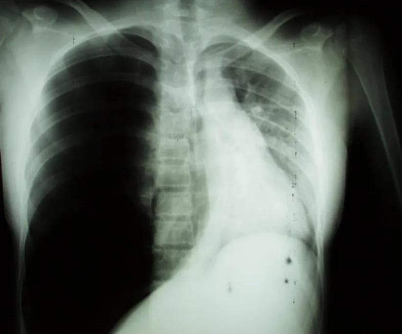 Imagen clínica de la pregunta de Respiratorio