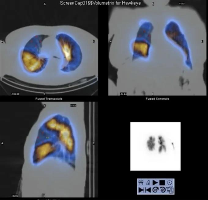 Imagen clínica de la pregunta de Respiratorio