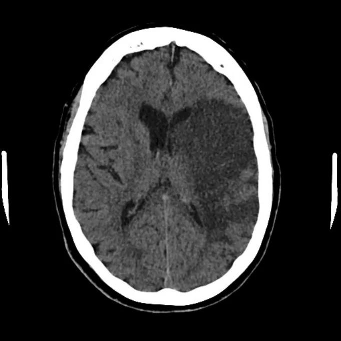 Imagen clínica de la pregunta de Neurología
