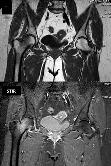 Imagen clínica de la pregunta de Traumatología
