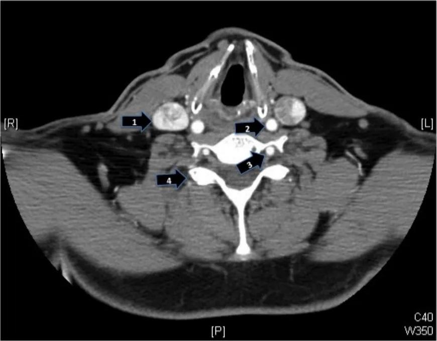Imagen clínica de la pregunta de Neurología