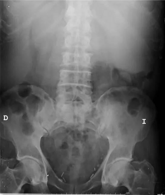 Imagen clínica de la pregunta de Hematología