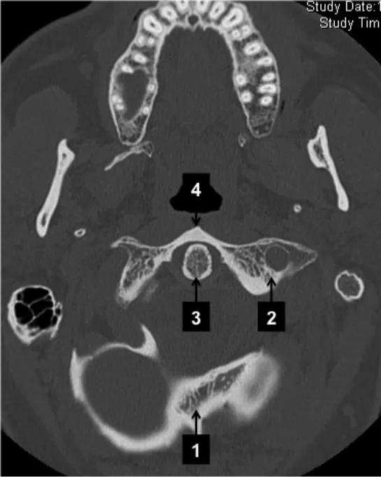 Imagen clínica de la pregunta de Traumatología