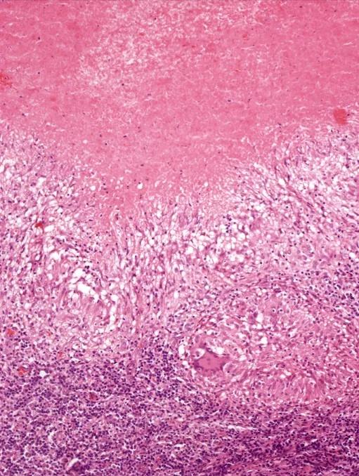 Imagen clínica de la pregunta de Hematología