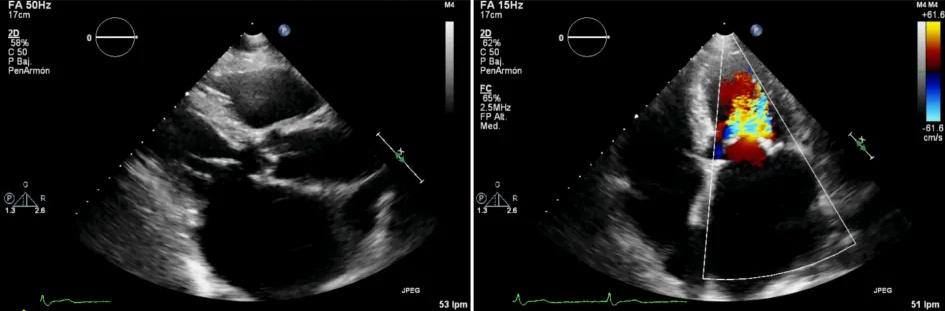 Imagen clínica de la pregunta de Cardiología