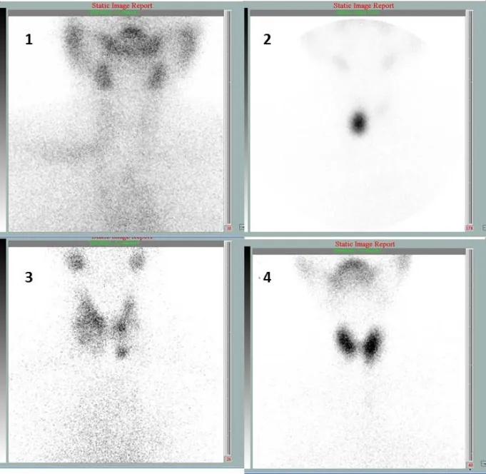 Imagen clínica de la pregunta de Endocrinología