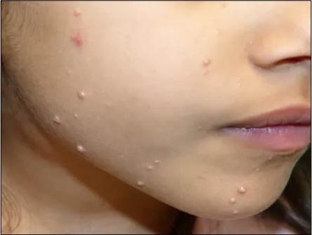 Imagen clínica de la pregunta de Dermatología
