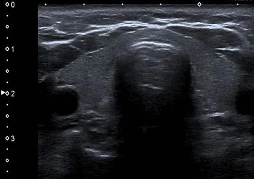 Imagen clínica de la pregunta de Endocrinología