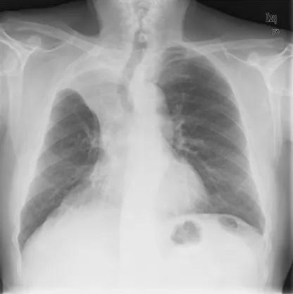 Imagen clínica de la pregunta de Respiratorio