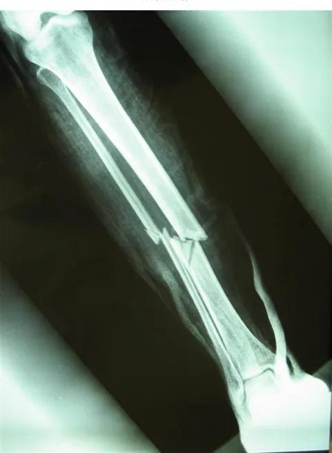Imagen clínica de la pregunta de Traumatología
