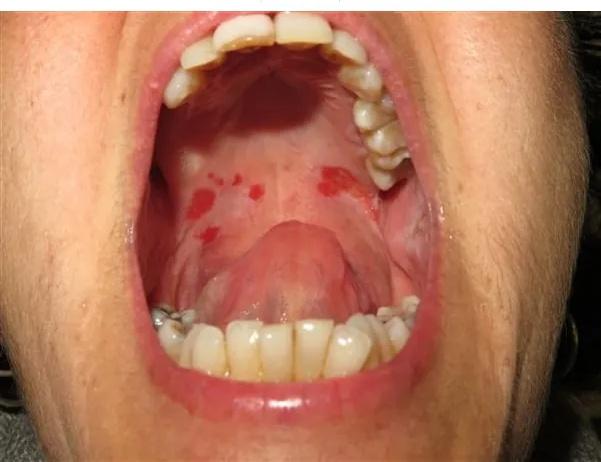 Imagen clínica de la pregunta de Dermatología