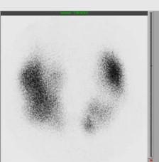 Imagen clínica de la pregunta de Endocrinología