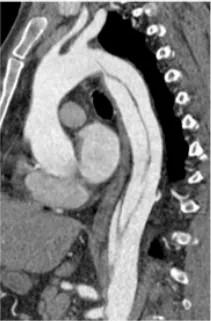 Imagen clínica de la pregunta de Cardiología
