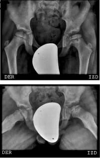 Imagen clínica de la pregunta de Traumatología