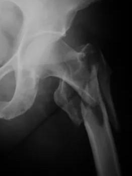 Imagen clínica de la pregunta de Traumatología