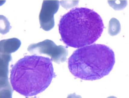 Imagen clínica de la pregunta de Hematología