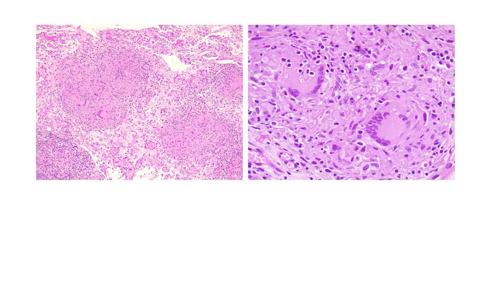 Imagen clínica de la pregunta de Oncología