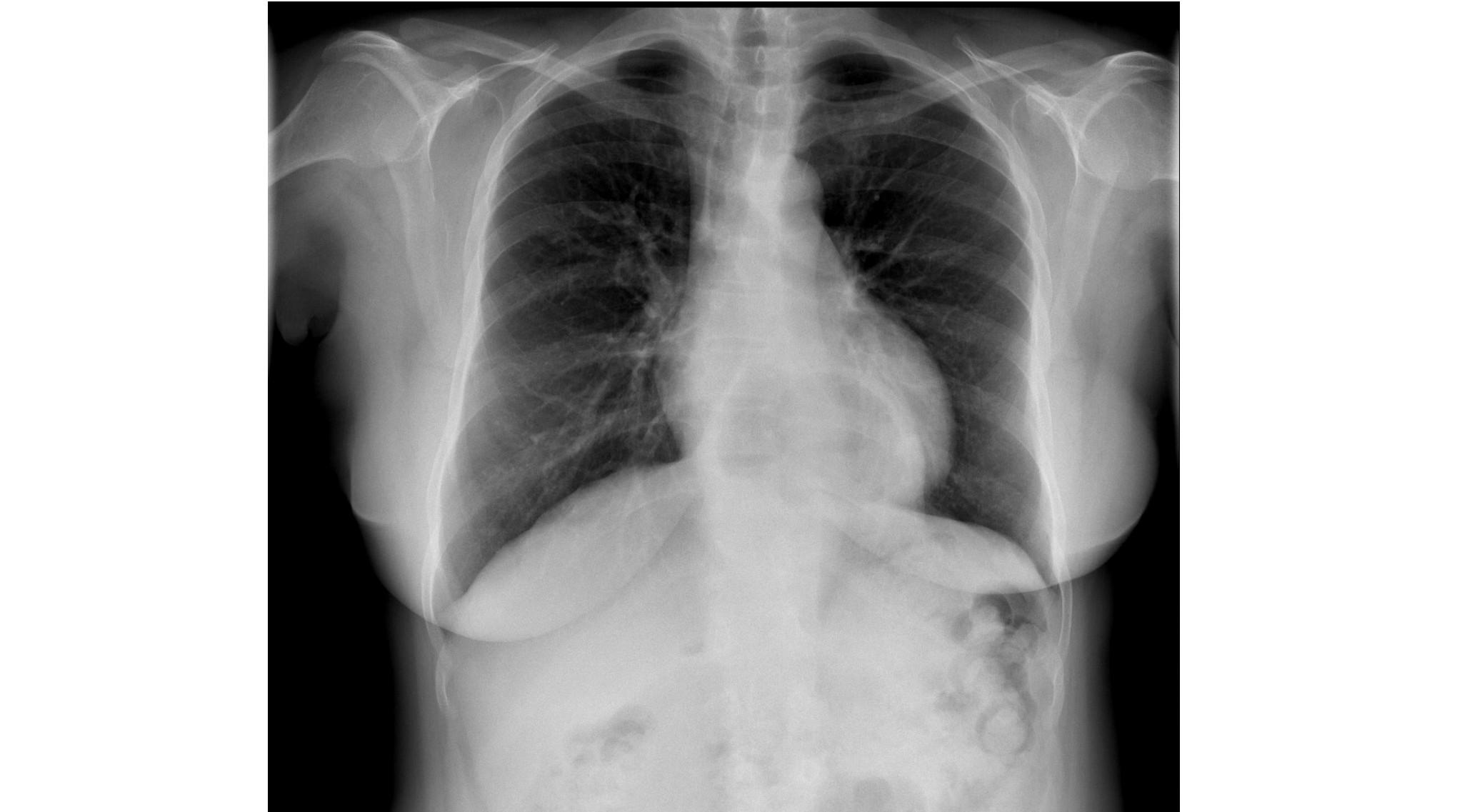 Imagen clínica de la pregunta de Cardiología
