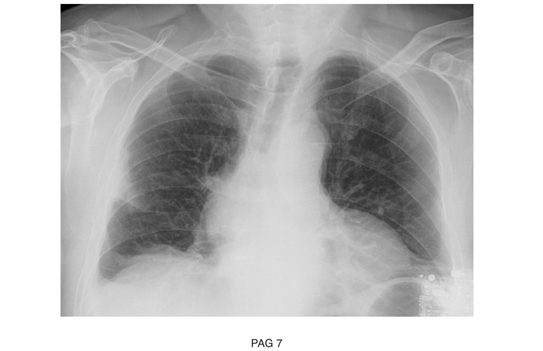 Imagen clínica de la pregunta de Respiratorio