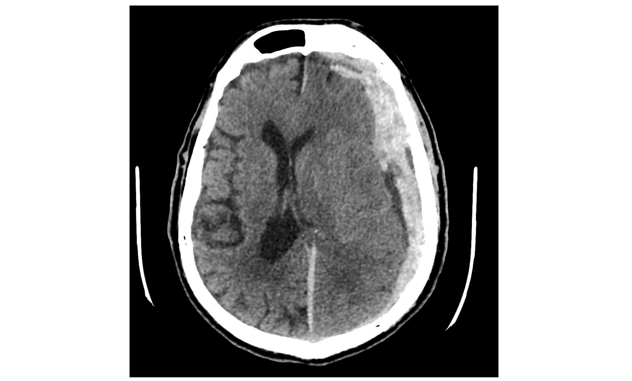 Imagen clínica de la pregunta de Neurología