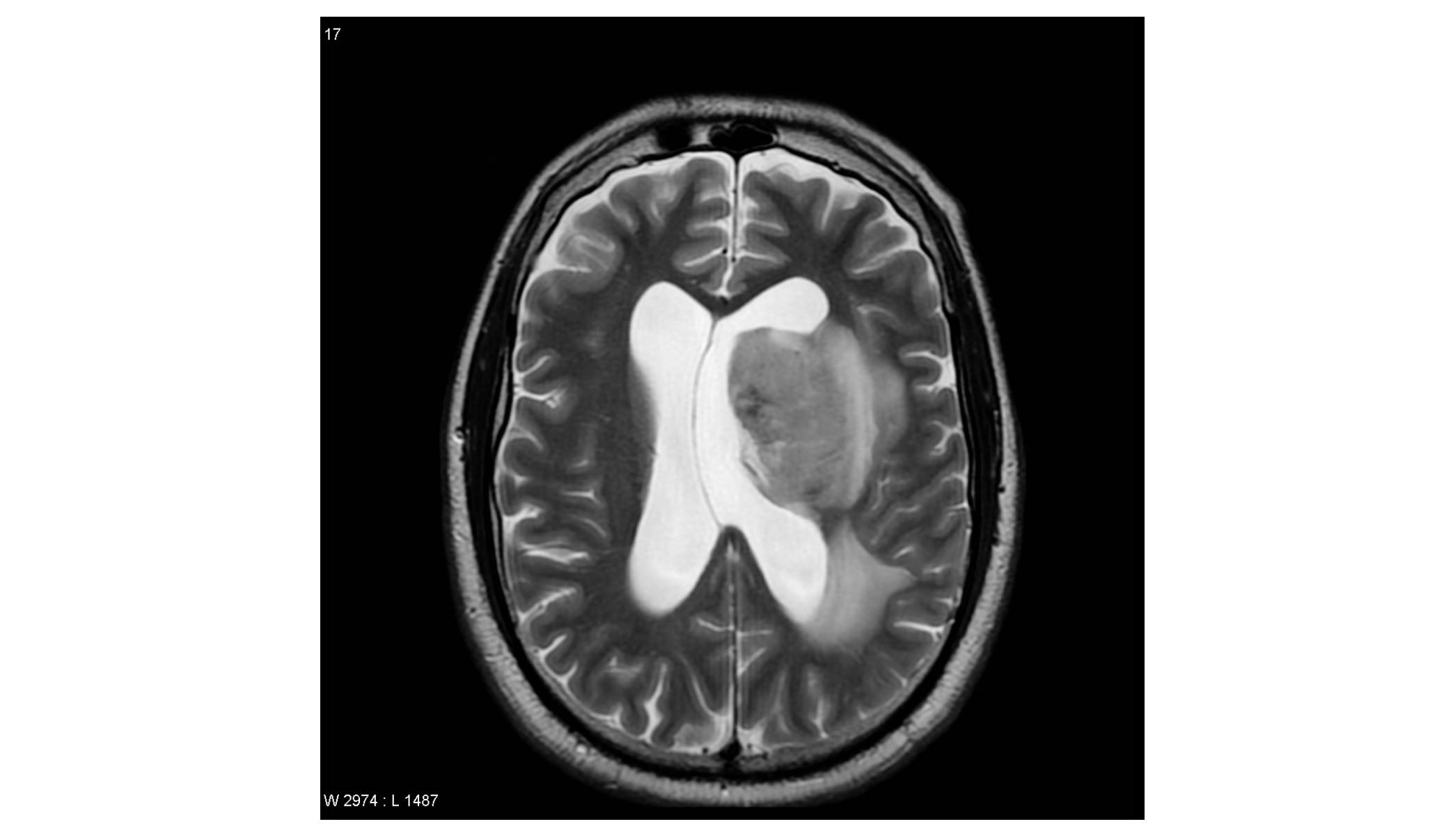 Imagen clínica de la pregunta de Infecciosas