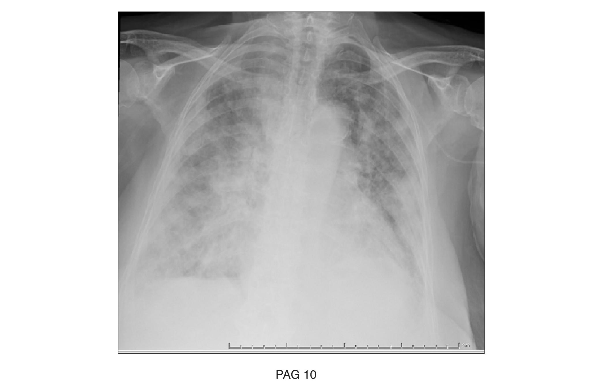 Imagen clínica de la pregunta de Infecciosas