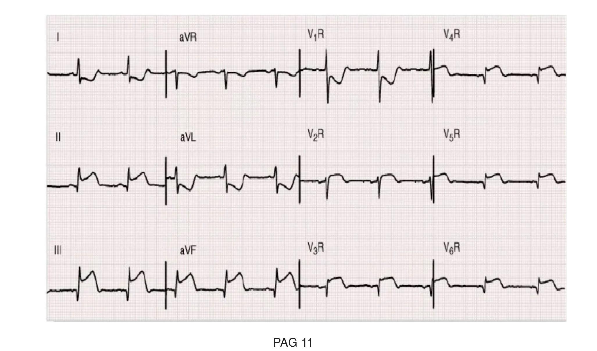 Imagen clínica de la pregunta de Cardiología