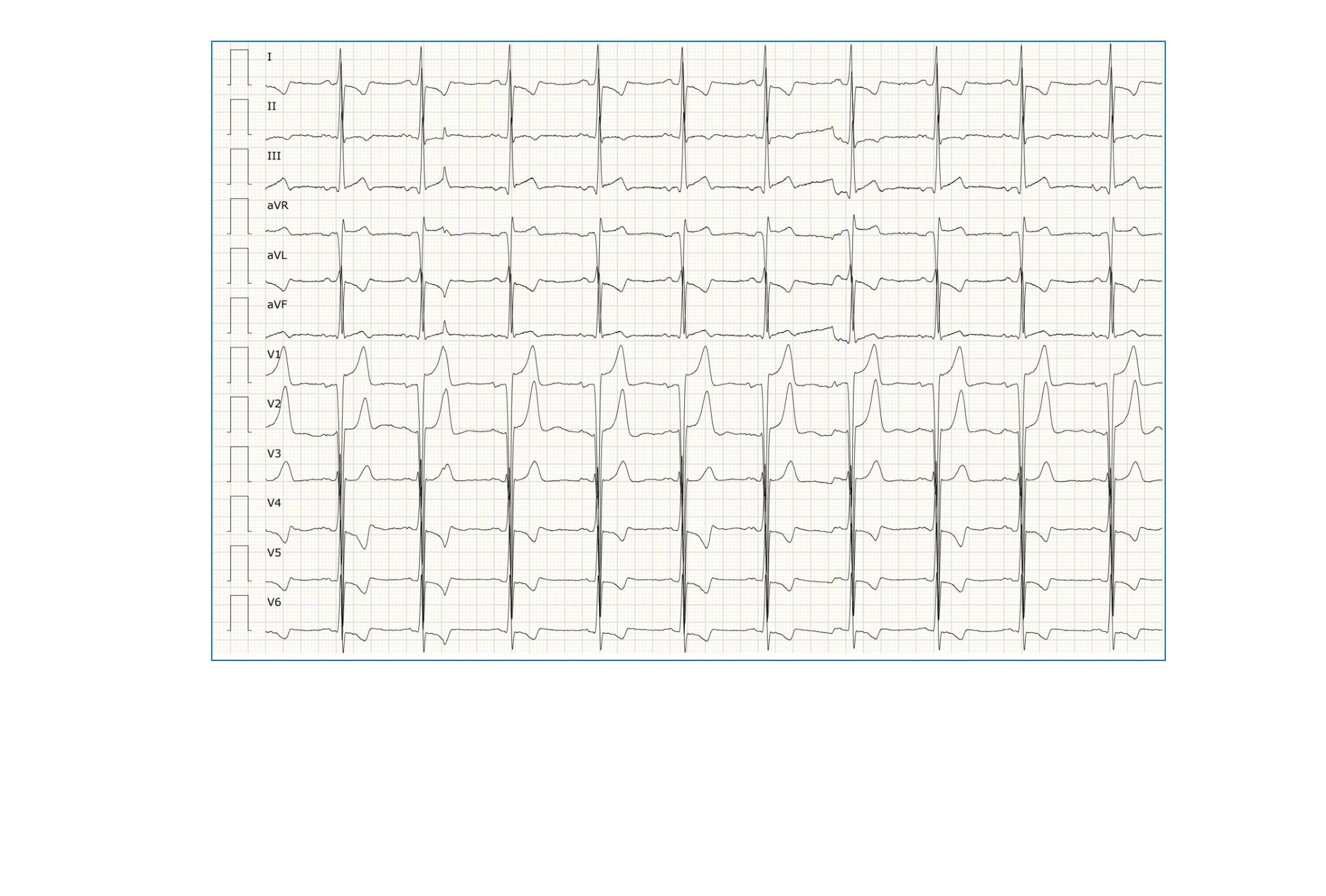 Imagen clínica de la pregunta de Cardiología