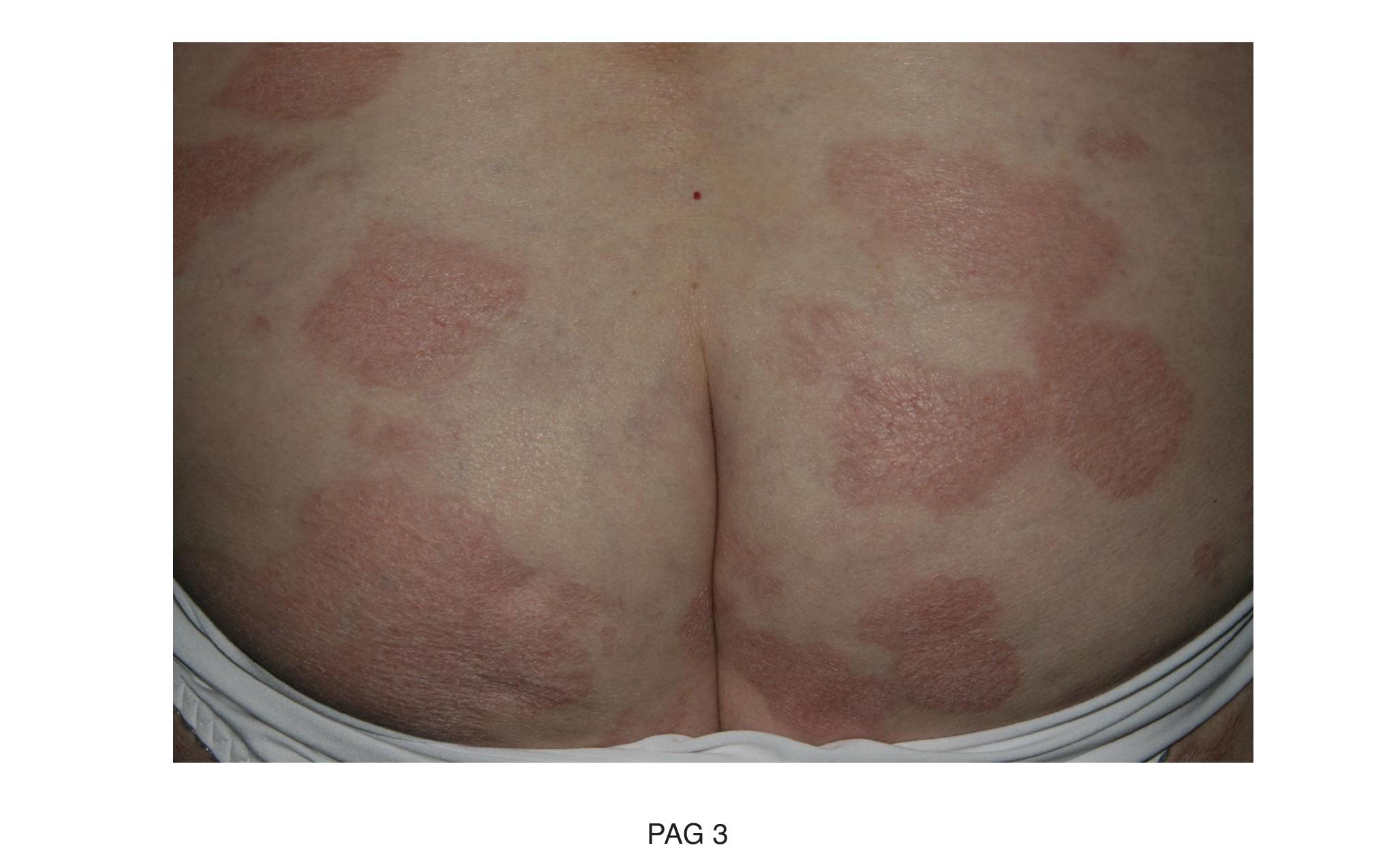 Imagen clínica de la pregunta de Hematología