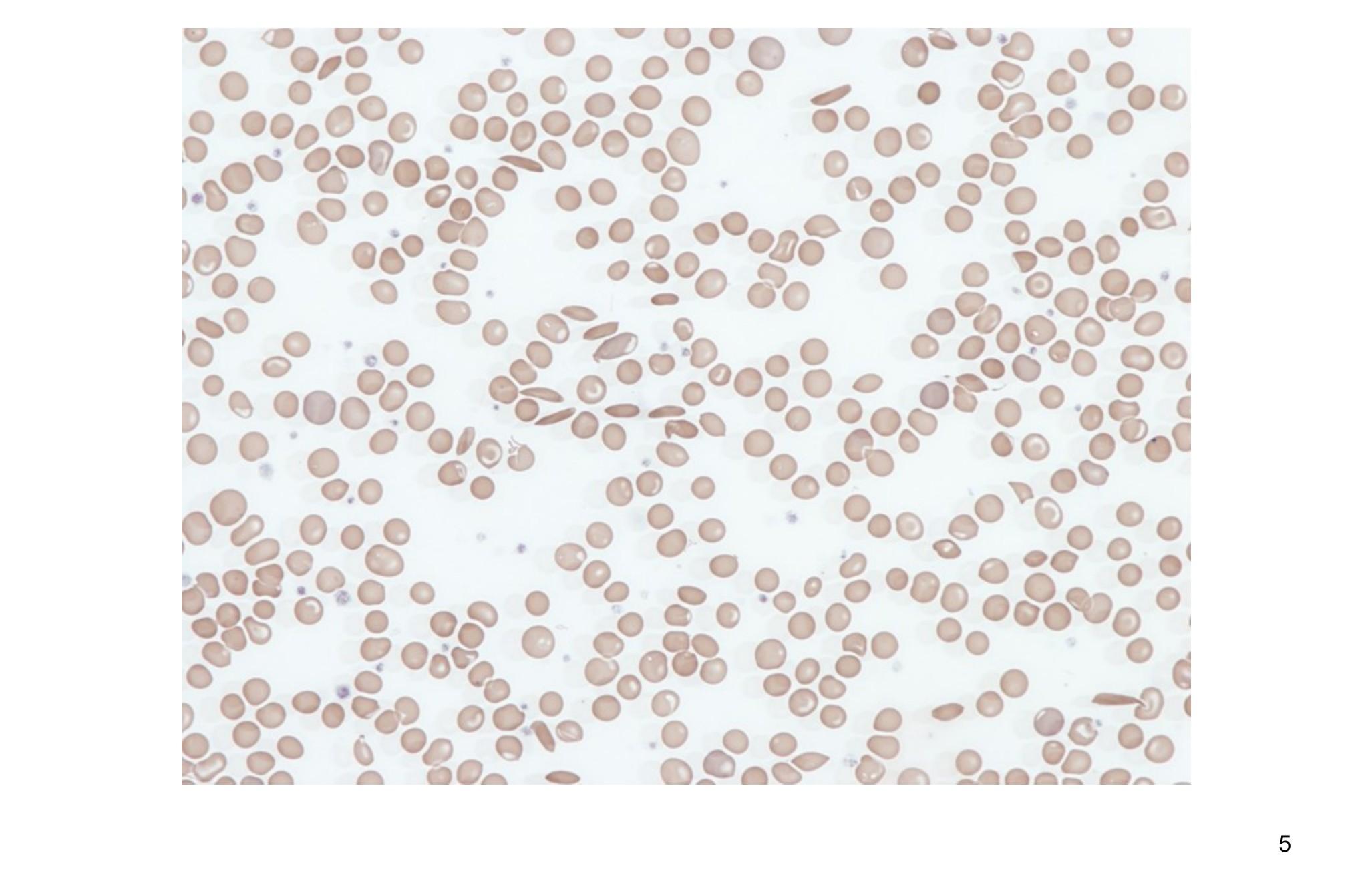 Imagen clínica de la pregunta de Hematología