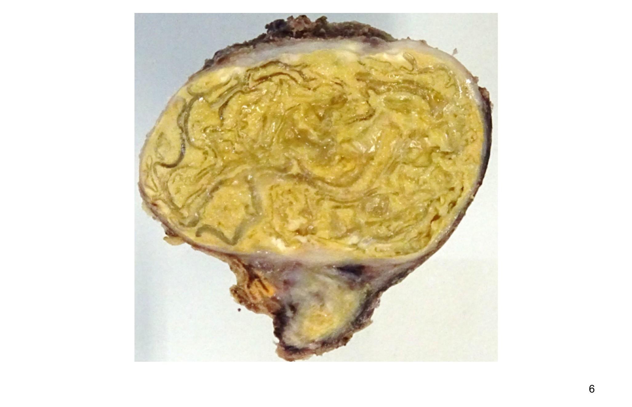 Imagen clínica de la pregunta de Oncología