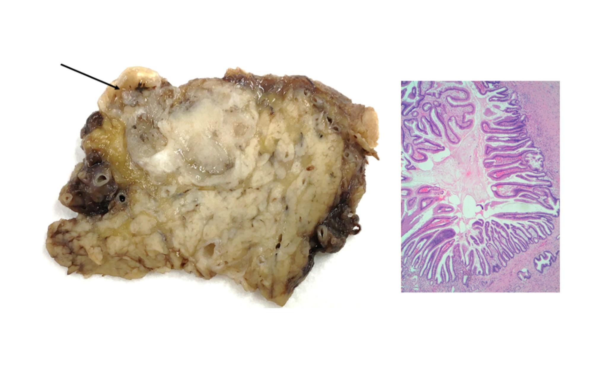 Imagen clínica de la pregunta de Oncología