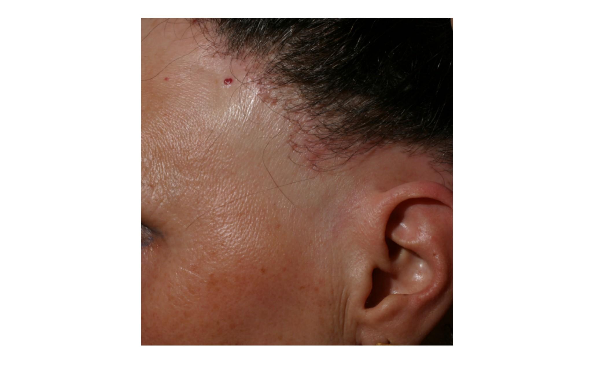 Imagen clínica de la pregunta de Dermatología