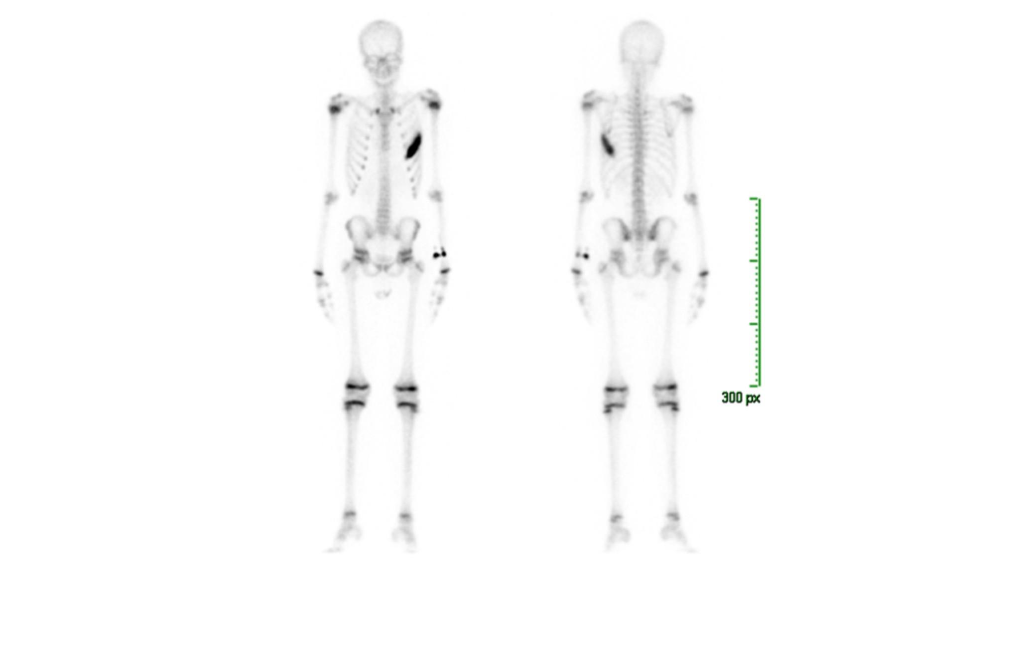 Imagen clínica de la pregunta de Oncología
