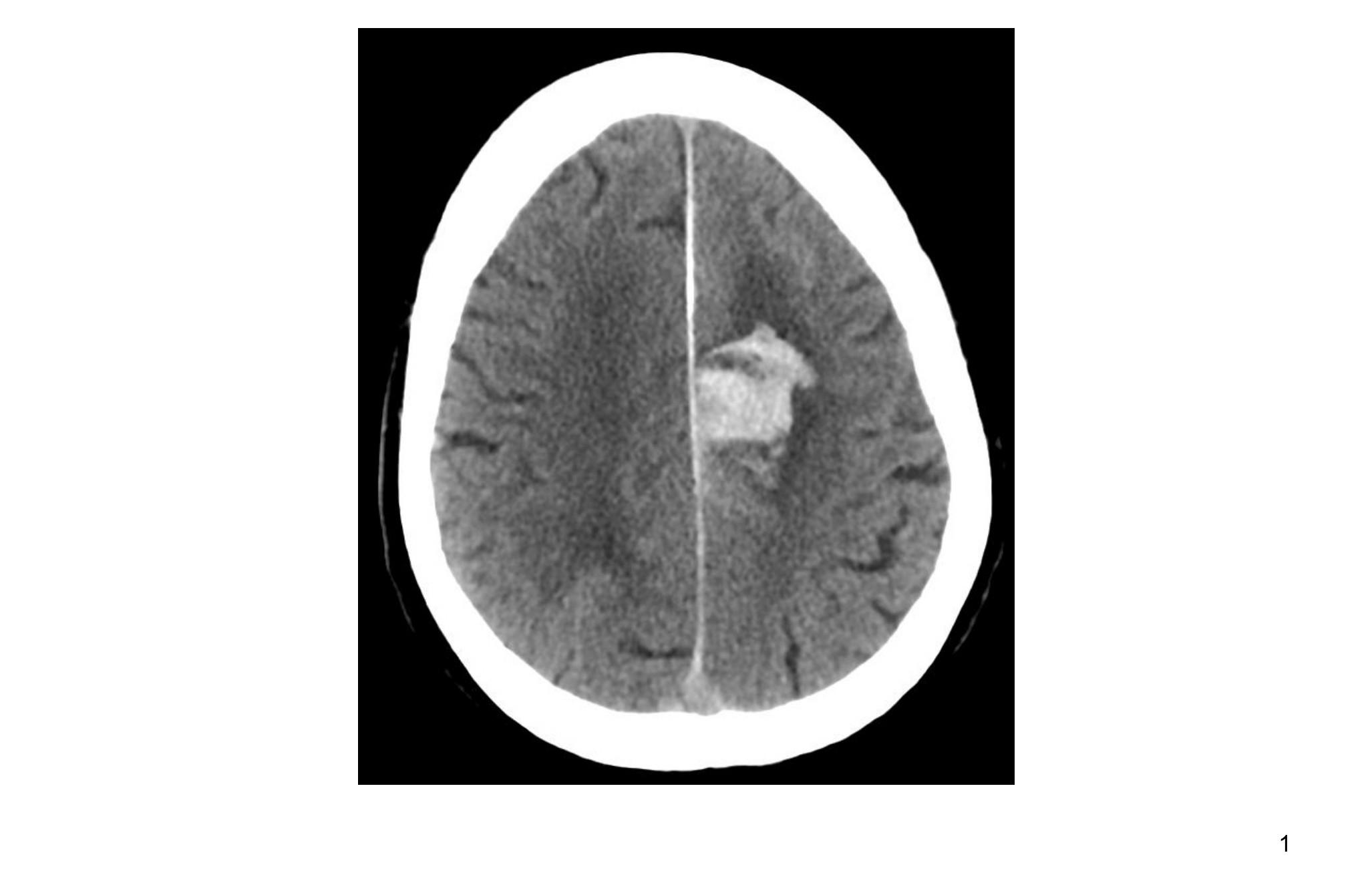 Imagen clínica de la pregunta de Neurología