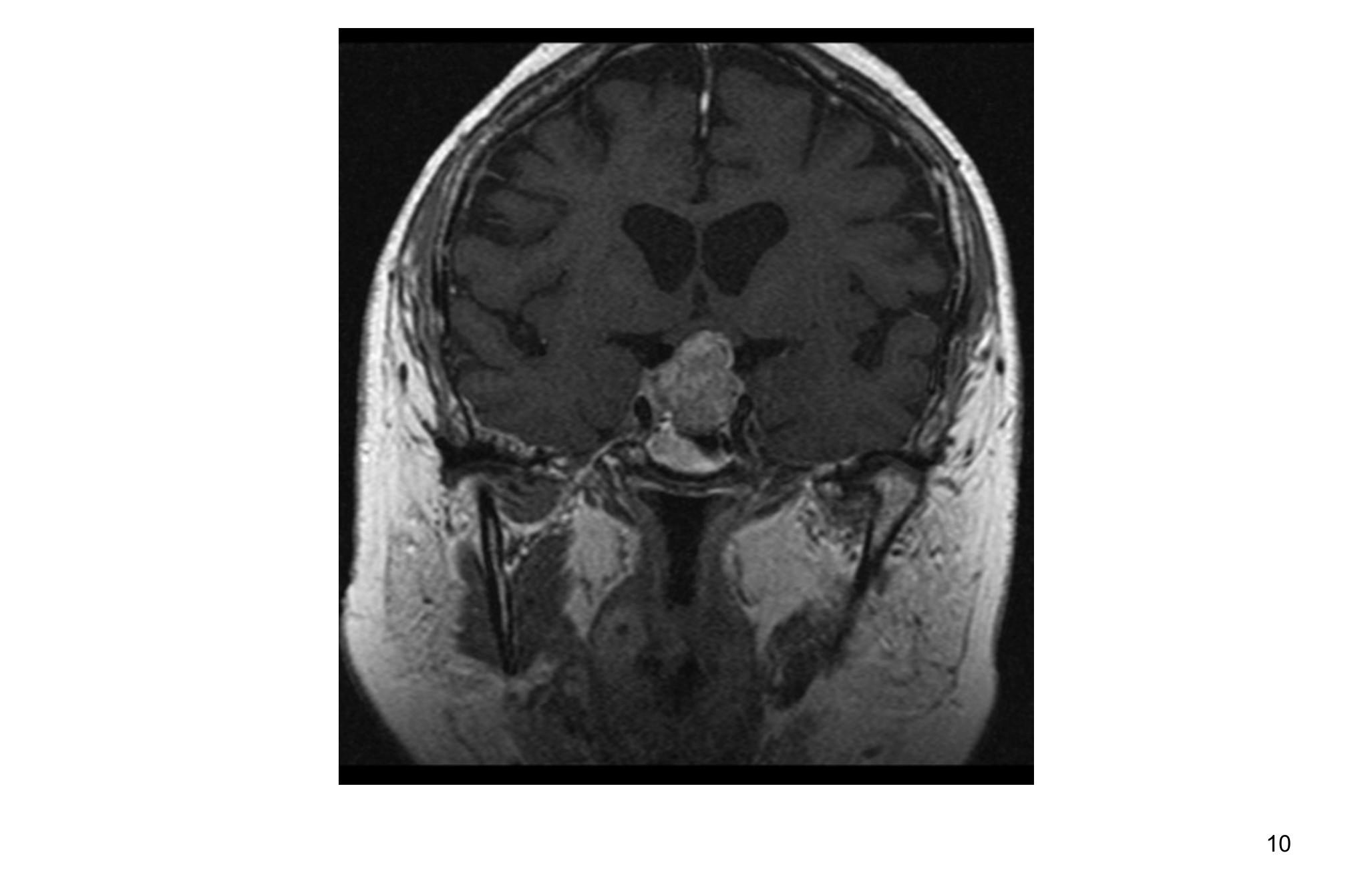 Imagen clínica de la pregunta de Oncología