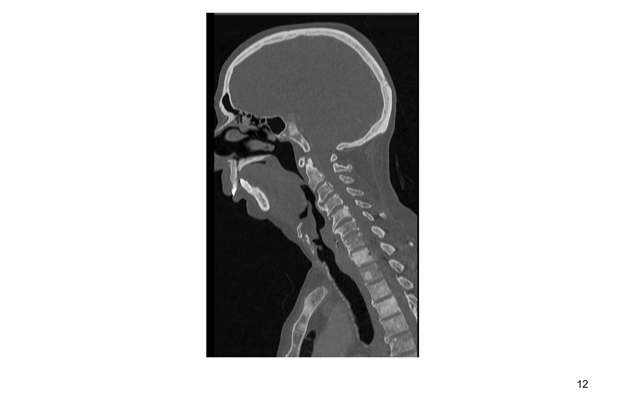 Imagen clínica de la pregunta de Oncología