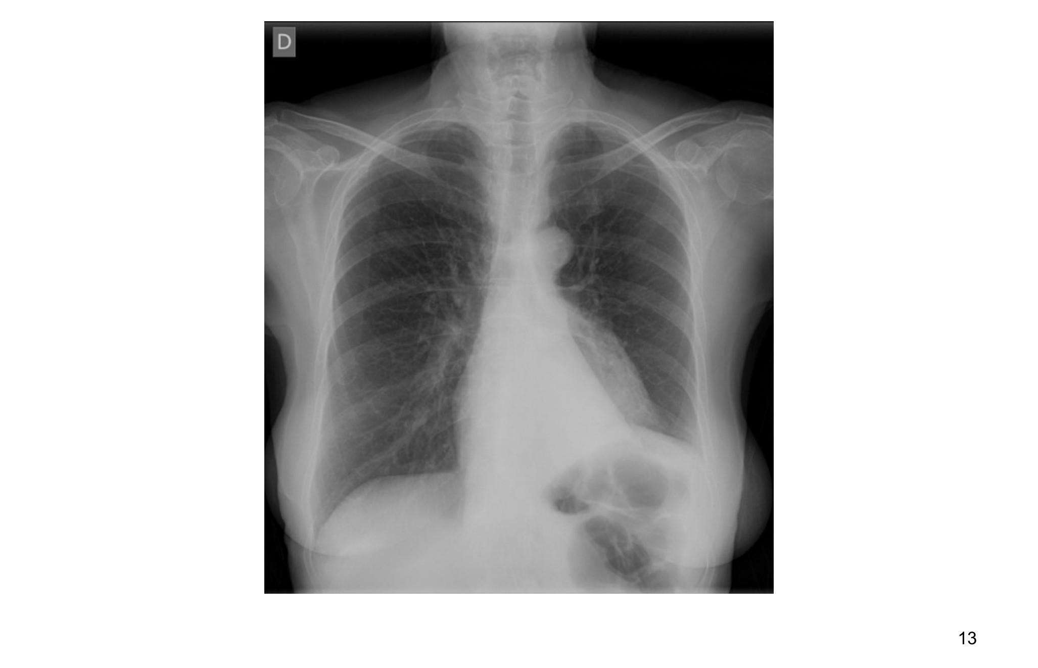 Imagen clínica de la pregunta de Respiratorio