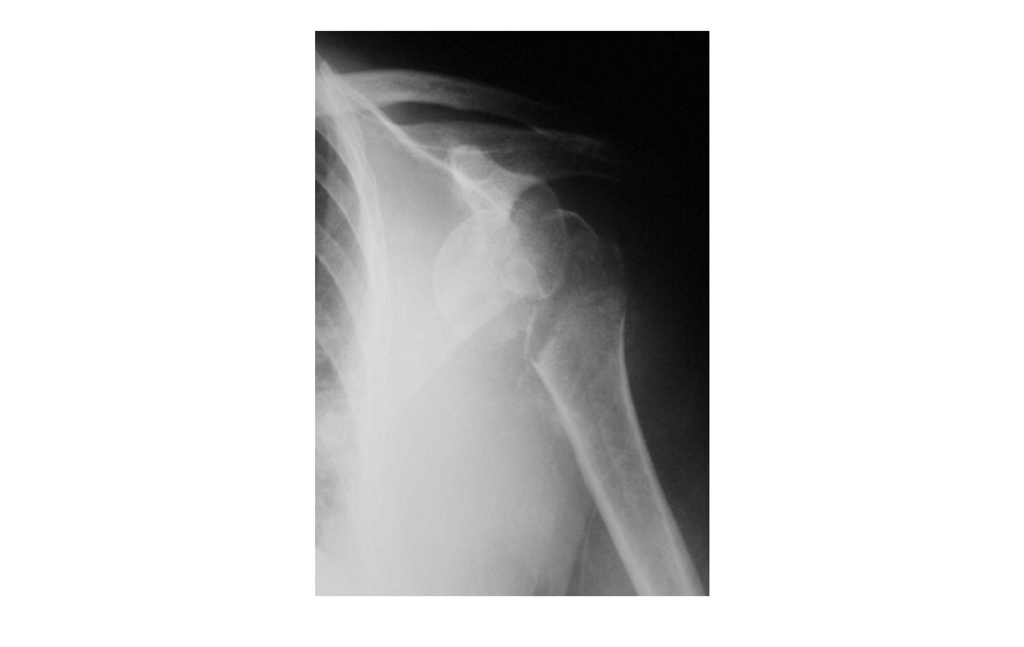 Imagen clínica de la pregunta de Traumatología